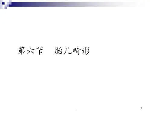 胎儿畸形PPT课件