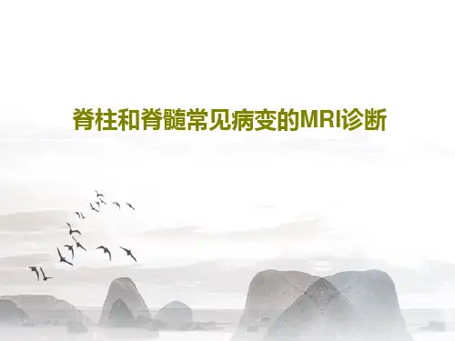 脊柱和脊髓常见病变的MRI诊断PPT68页