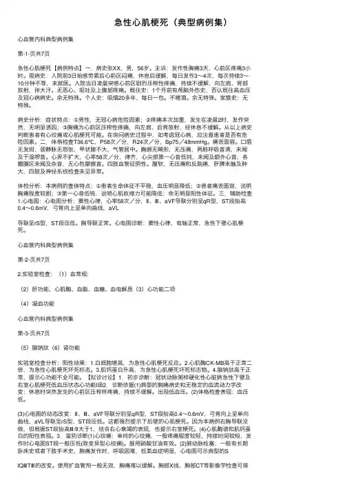 急性心肌梗死（典型病例集）