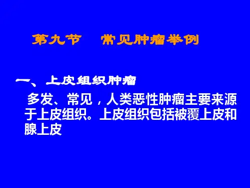 病理第五章肿瘤3
