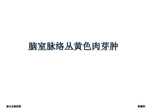 脑室脉络丛黄色肉芽肿影像表现及鉴别诊断(自己病例)