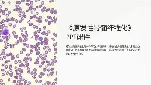 《原发性骨髓纤维化》课件