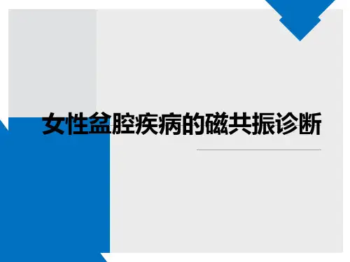 女性盆腔疾病的MRI诊断