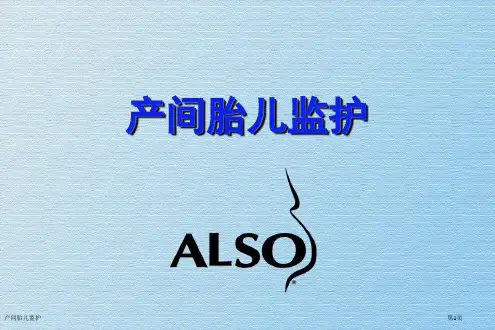 产间胎儿监护