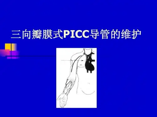 黄汝梁：三向瓣膜式PICC导管的维护