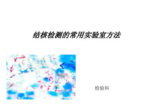 结核检测方法(2)0000
