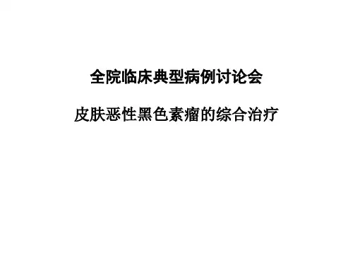 病例讨论-黑色素瘤课件