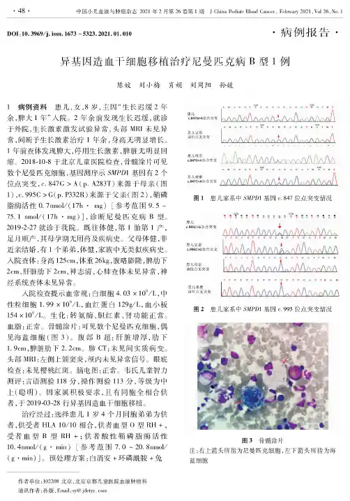 异基因造血干细胞移植治疗尼曼匹克病B型1例