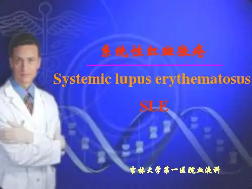SLE