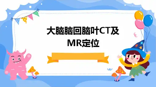 2024版大脑脑回脑叶CT及MR定位