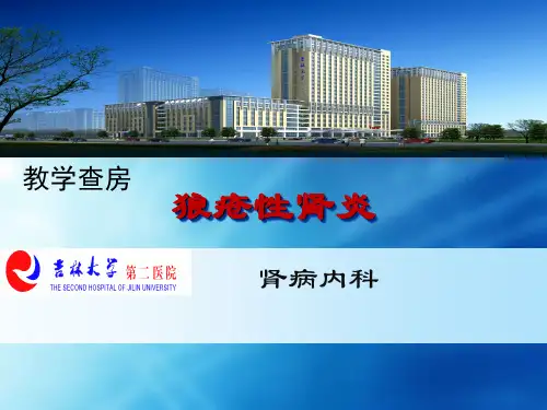 系统性红斑狼疮 SLE教学查房(1)