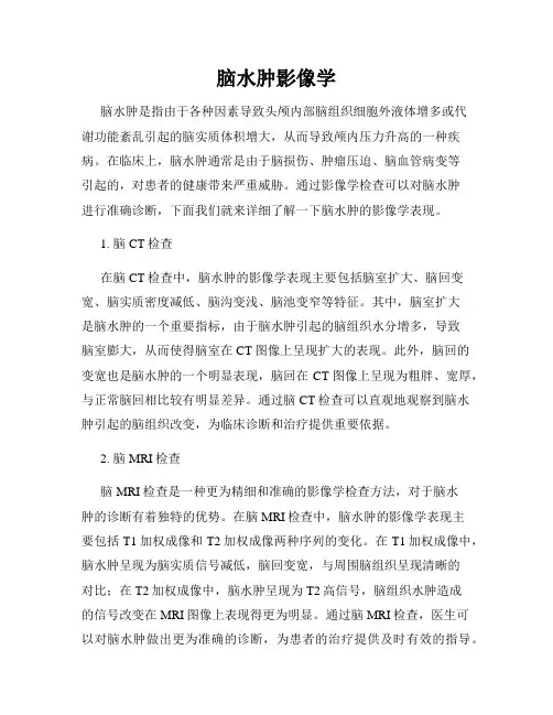 脑水肿影像学