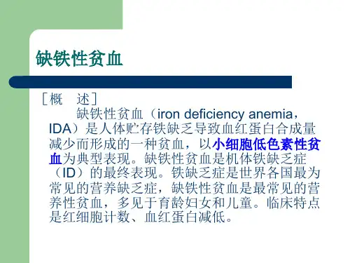 缺铁性贫血