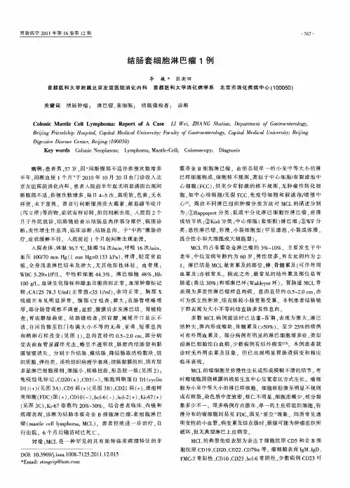 结肠套细胞淋巴瘤1例