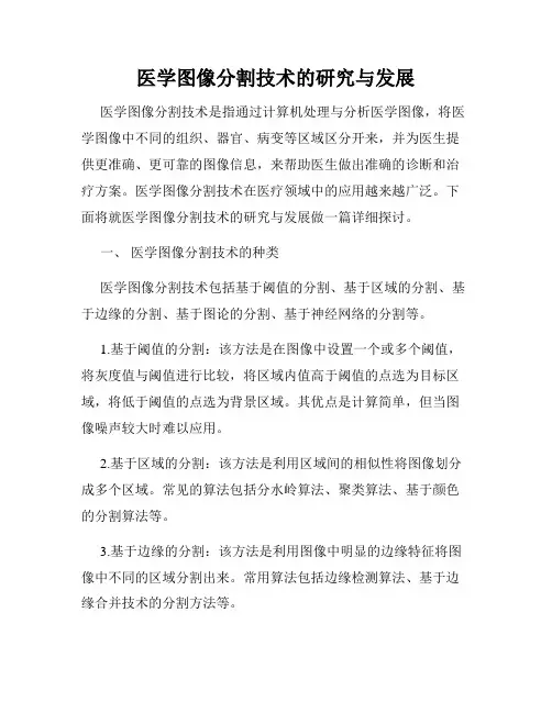 医学图像分割技术的研究与发展
