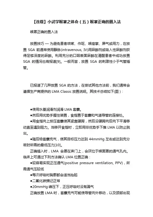 【连载】小武学喉罩之体会（五）喉罩正确的置入法