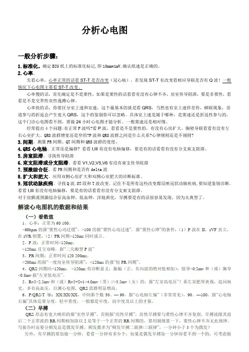 分析心电图入门讲解