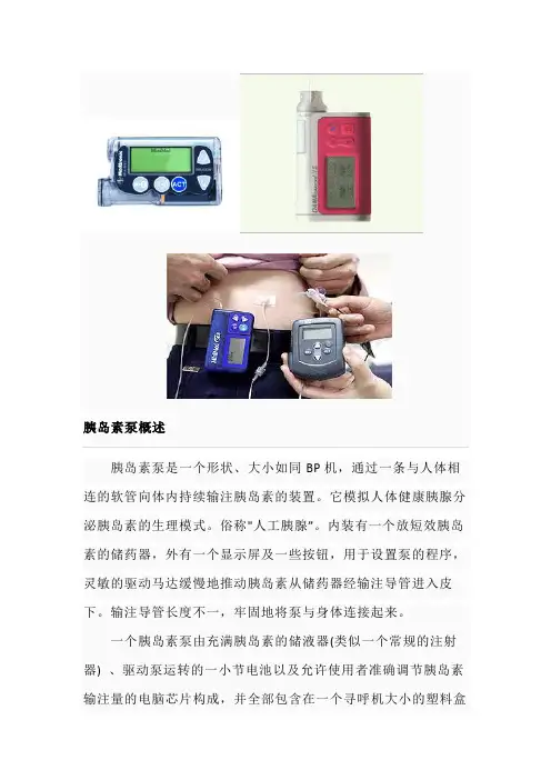 胰岛素泵使用及注意事项
