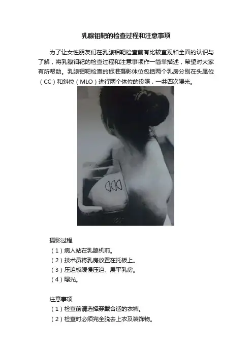 乳腺钼靶的检查过程和注意事项