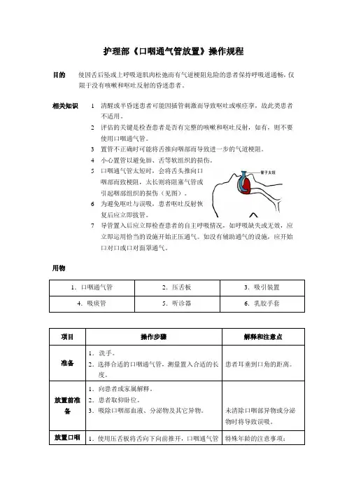 护理部《口咽通气管放置》操作规程