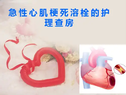 急性心肌梗死的溶栓护理查房课件ppt