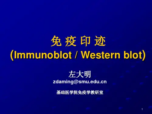 免疫印迹