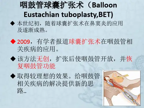 咽鼓管球囊扩张术及其应用