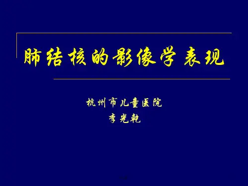 肺结核(TB)的影像学表现(汇总).ppt