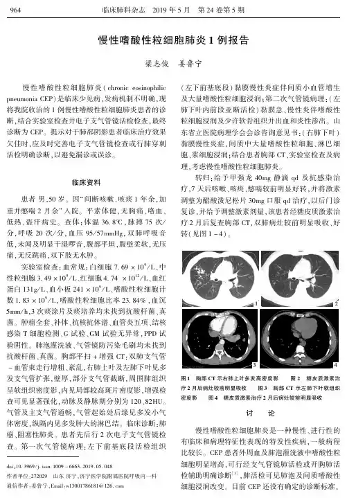 慢性嗜酸性粒细胞肺炎1例报告