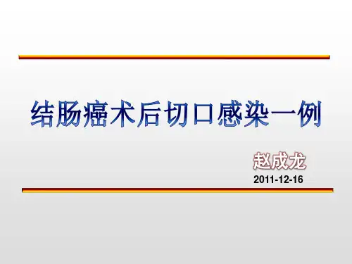 病例分析-结肠癌术后切口感染一例