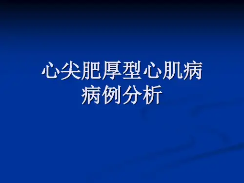 心尖肥厚型心肌病(1)