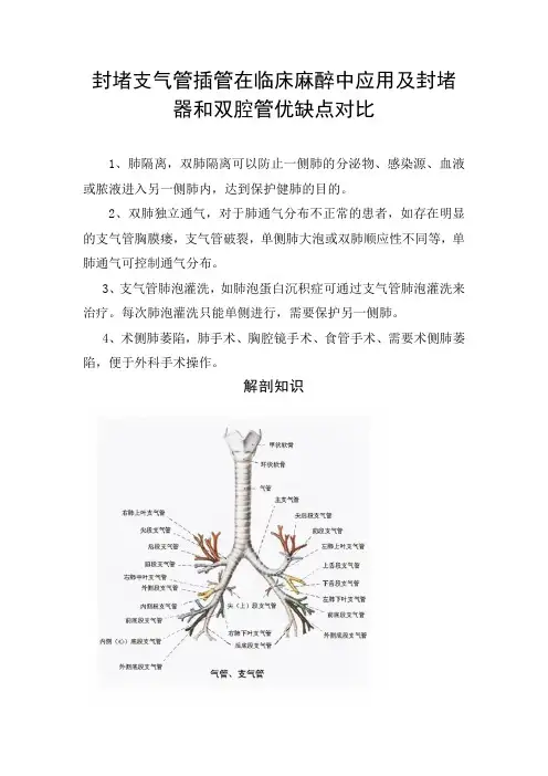 封堵支气管插管在临床麻醉中应用及封堵器和双腔管优缺点对比