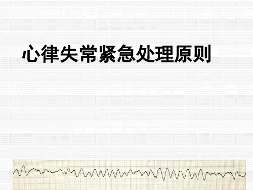 心律失常紧急处理原则精品PPT课件