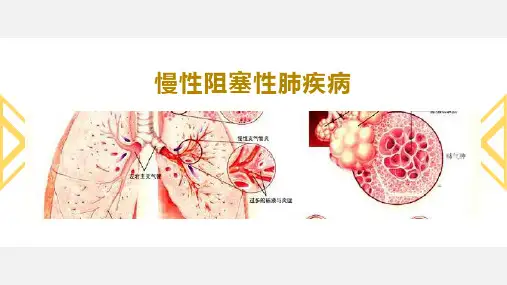 慢性阻塞性肺疾病康复(精品图文课件)