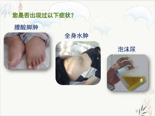 糖尿病肾病篇课件-PPT