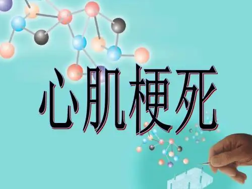 心肌梗死教育查房