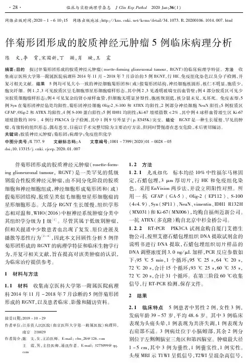 伴菊形团形成的胶质神经元肿瘤5例临床病理分析