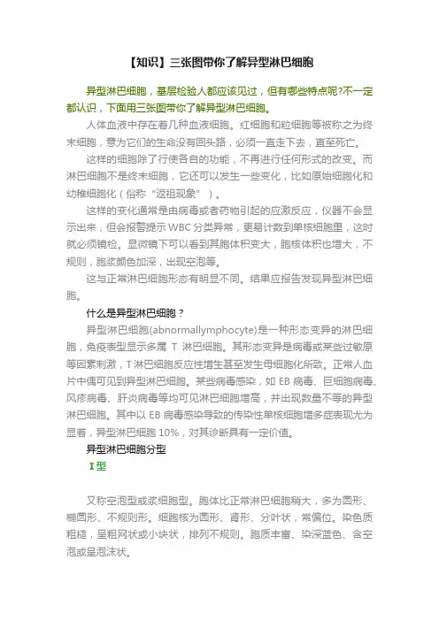 【知识】三张图带你了解异型淋巴细胞