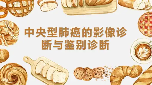 中央型肺癌的影像诊断与鉴别诊断