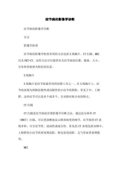 结节病的影像学诊断