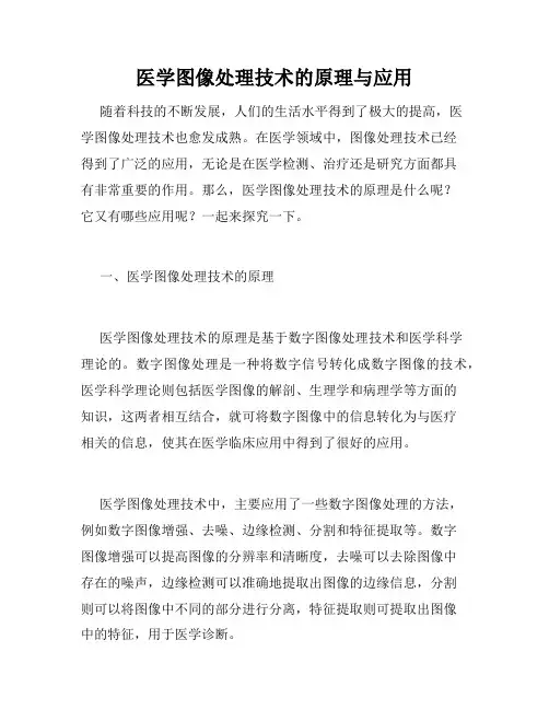 医学图像处理技术的原理与应用