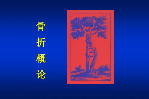 骨折概论【84页】