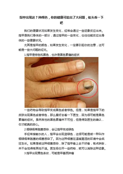 指甲出现这7种颜色，你的健康可能出了大问题，低头看一下吧