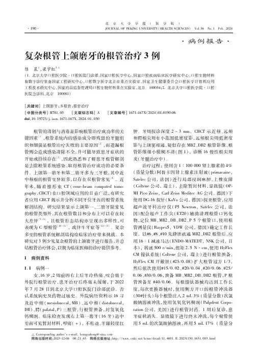 复杂根管上颌磨牙的根管治疗3例