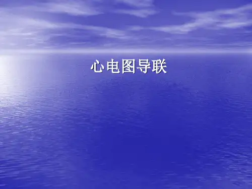心电图导联