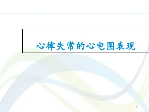 常见心律失常的心电图表现  ppt课件