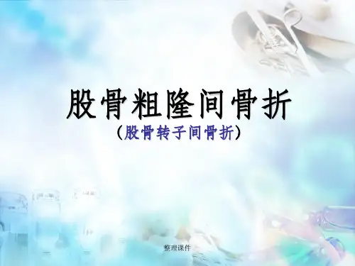 《股骨粗隆间骨折》