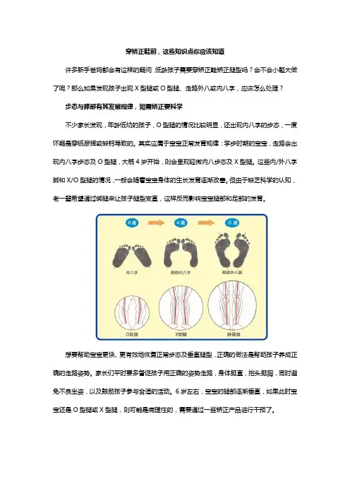 穿矫正鞋前,这些知识点你应该知道