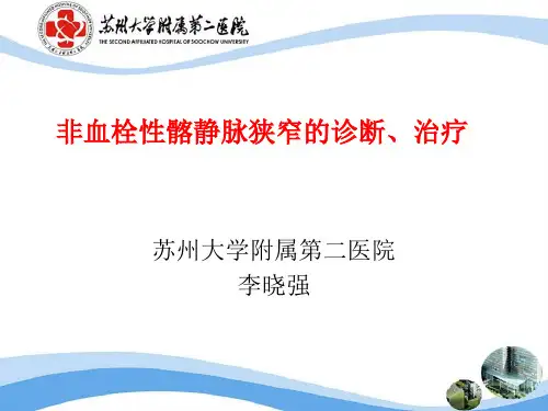 济宁髂静脉受压
