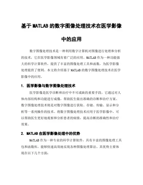 基于MATLAB的数字图像处理技术在医学影像中的应用